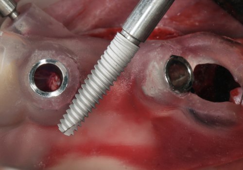 Which of the following is the most common complication from implant surgery?