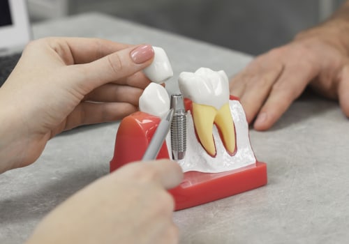 What is the best pain relief after dental implants?